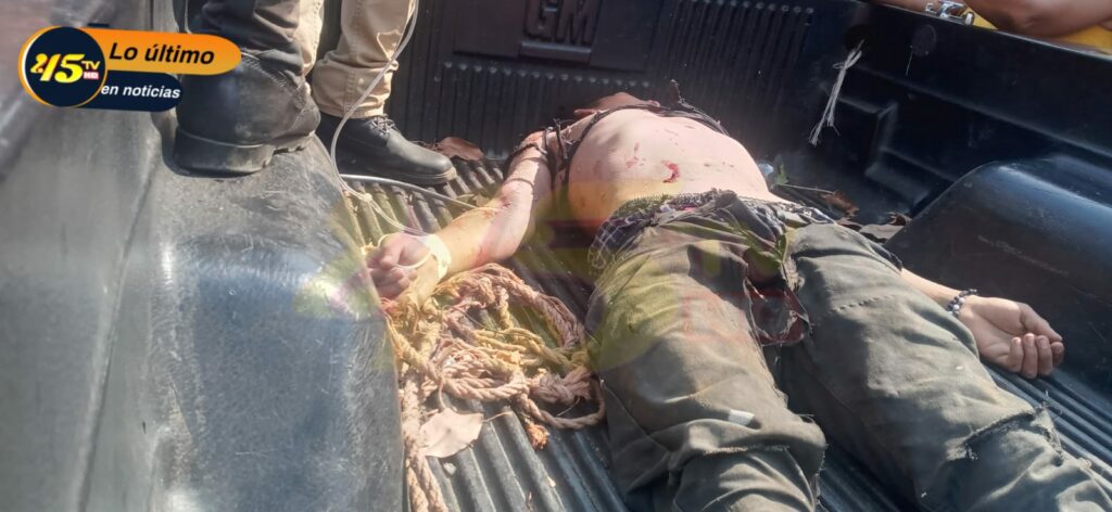 Muchacho de 17 años por poco muere electrocutado en Campamento, Olancho.